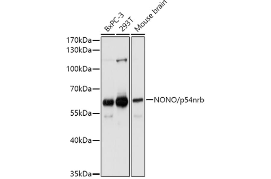 Western Blot - Anti-nmt55/p54nrb Antibody (A14639) - Antibodies.com