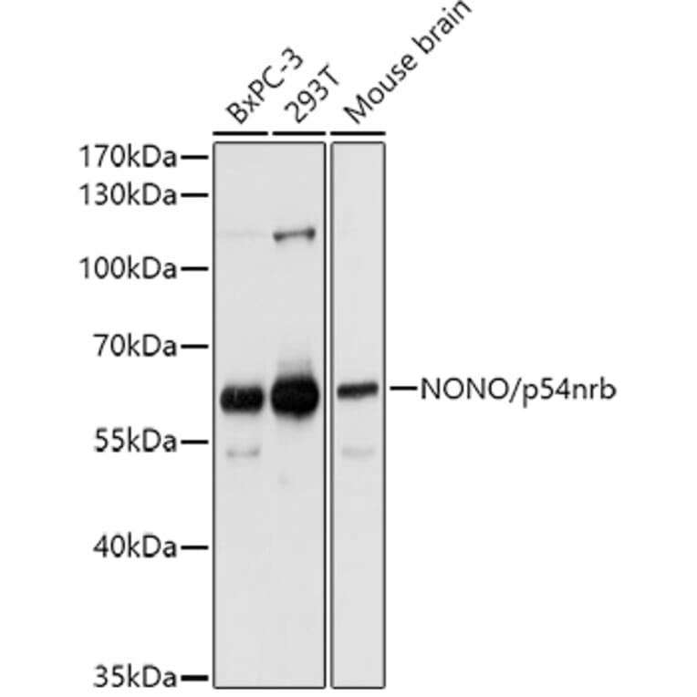 Western Blot - Anti-nmt55/p54nrb Antibody (A14639) - Antibodies.com