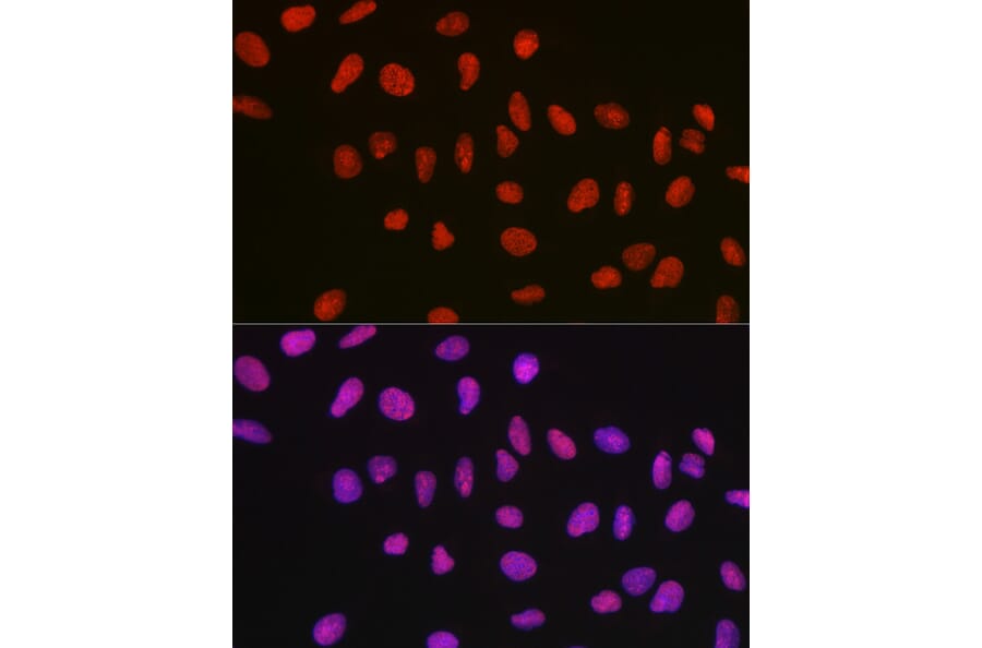 Immunofluorescence - Anti-nmt55/p54nrb Antibody (A14639) - Antibodies.com