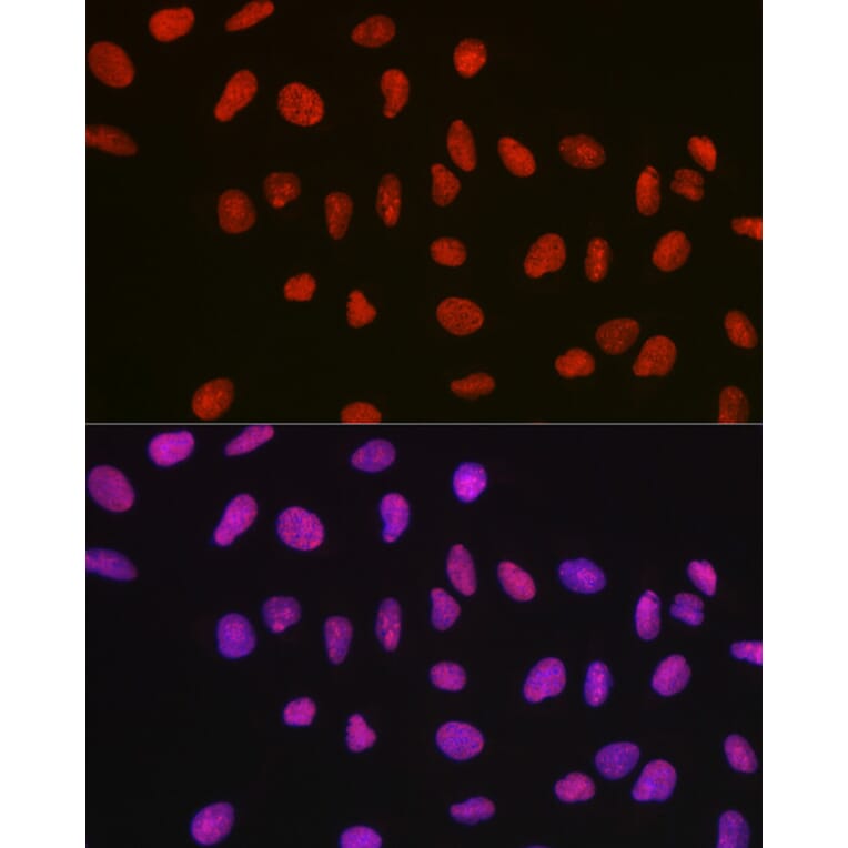 Immunofluorescence - Anti-nmt55/p54nrb Antibody (A14639) - Antibodies.com