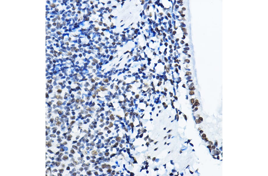 Immunohistochemistry - Anti-nmt55/p54nrb Antibody (A14639) - Antibodies.com