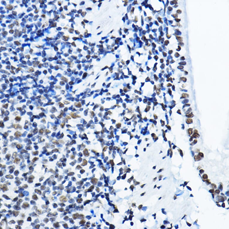 Immunohistochemistry - Anti-nmt55/p54nrb Antibody (A14639) - Antibodies.com
