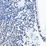 Immunohistochemistry - Anti-nmt55/p54nrb Antibody (A14639) - Antibodies.com