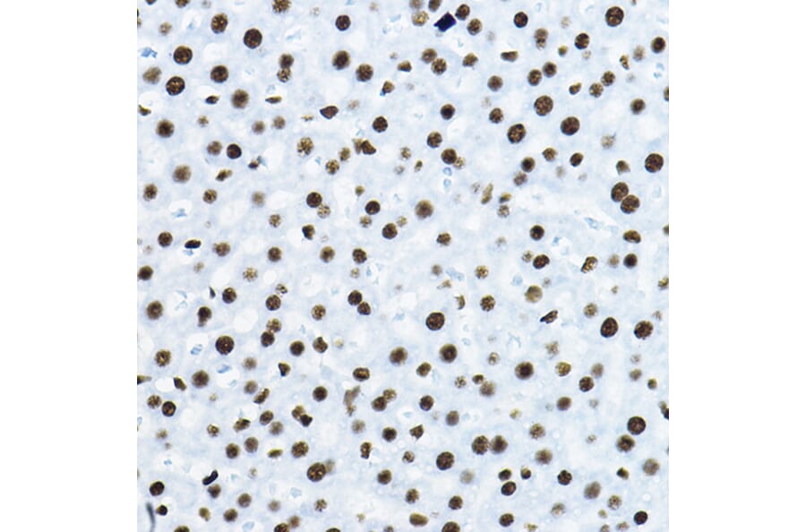 Immunohistochemistry - Anti-nmt55/p54nrb Antibody (A14639) - Antibodies.com