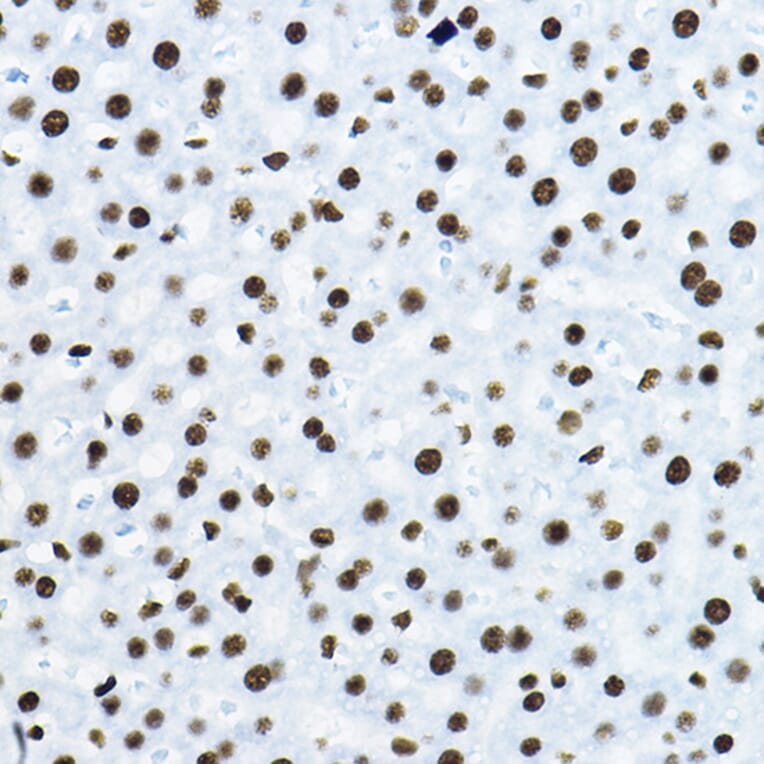 Immunohistochemistry - Anti-nmt55/p54nrb Antibody (A14639) - Antibodies.com