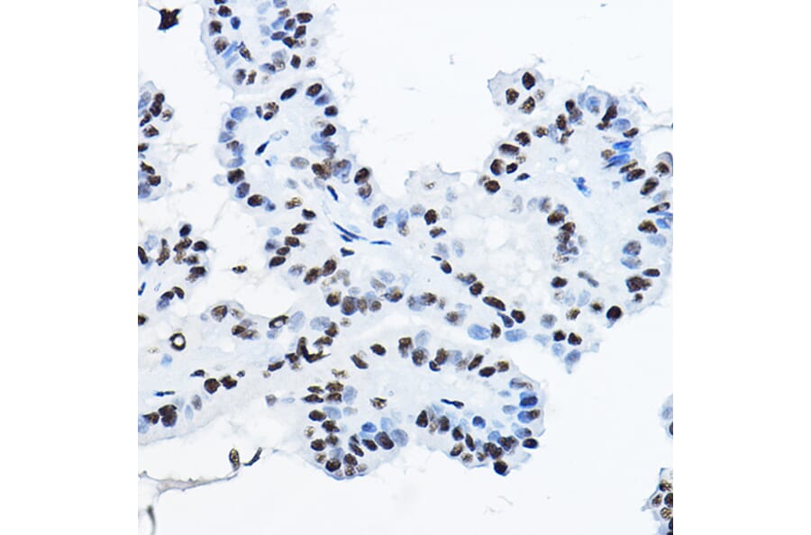 Immunohistochemistry - Anti-nmt55/p54nrb Antibody (A14639) - Antibodies.com