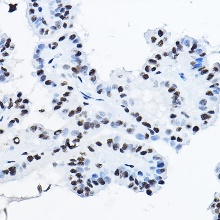 Immunohistochemistry - Anti-nmt55/p54nrb Antibody (A14639) - Antibodies.com