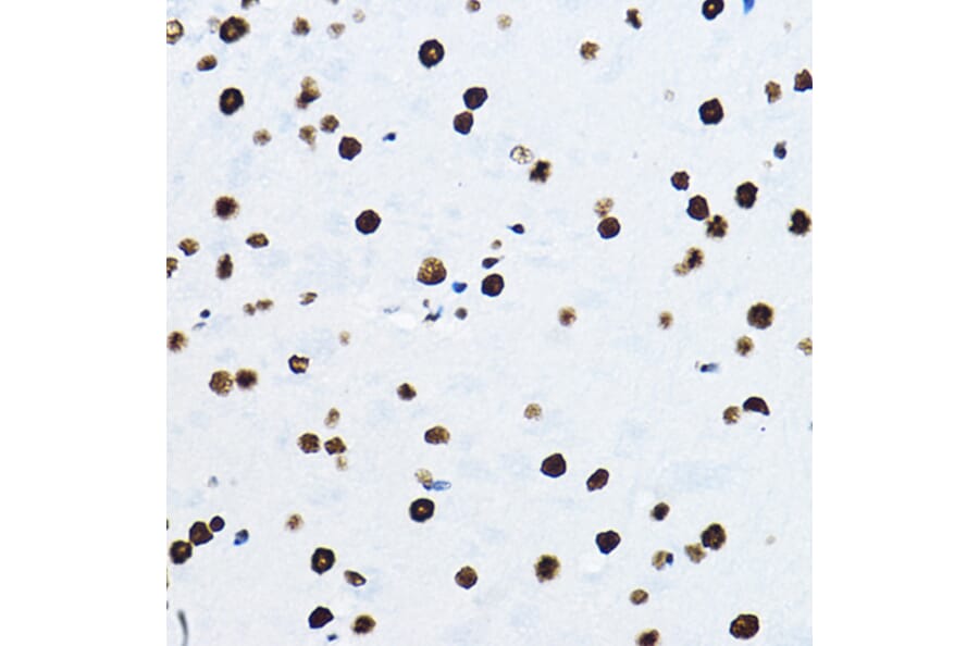 Immunohistochemistry - Anti-nmt55/p54nrb Antibody (A14639) - Antibodies.com