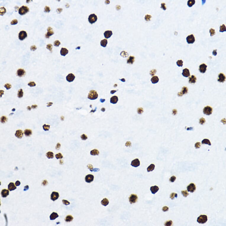 Immunohistochemistry - Anti-nmt55/p54nrb Antibody (A14639) - Antibodies.com