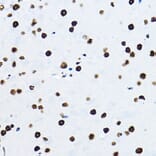 Immunohistochemistry - Anti-nmt55/p54nrb Antibody (A14639) - Antibodies.com
