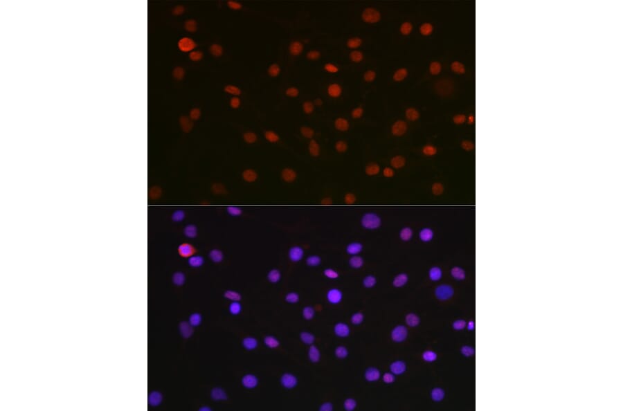 Immunofluorescence - Anti-nmt55/p54nrb Antibody (A14639) - Antibodies.com