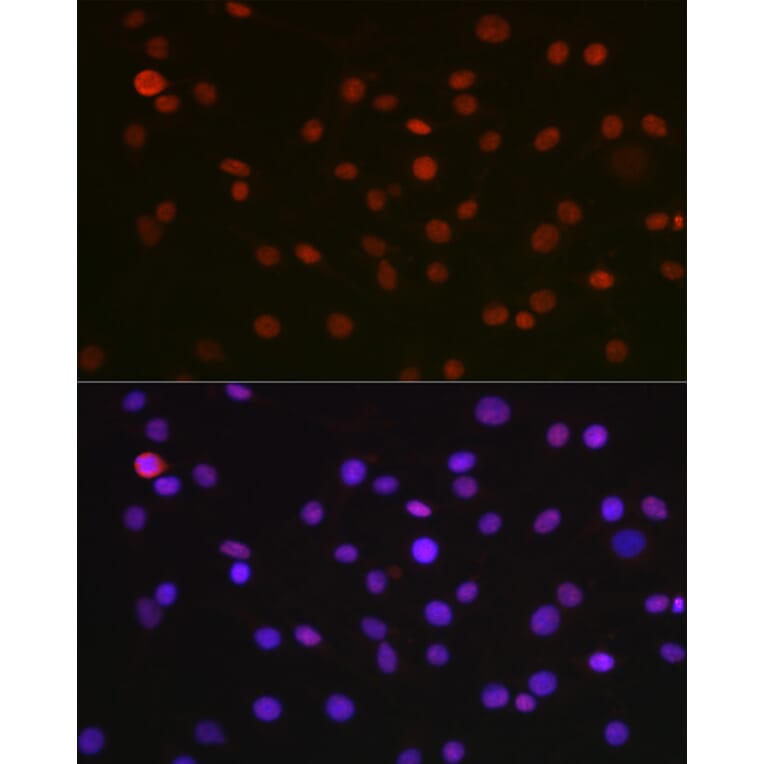 Immunofluorescence - Anti-nmt55/p54nrb Antibody (A14639) - Antibodies.com