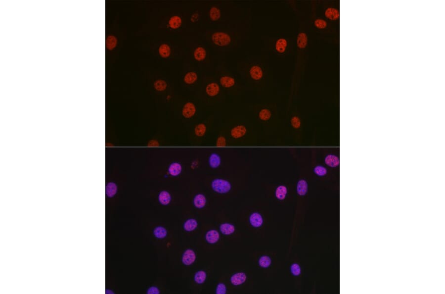 Immunofluorescence - Anti-nmt55/p54nrb Antibody (A14639) - Antibodies.com