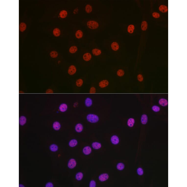 Immunofluorescence - Anti-nmt55/p54nrb Antibody (A14639) - Antibodies.com