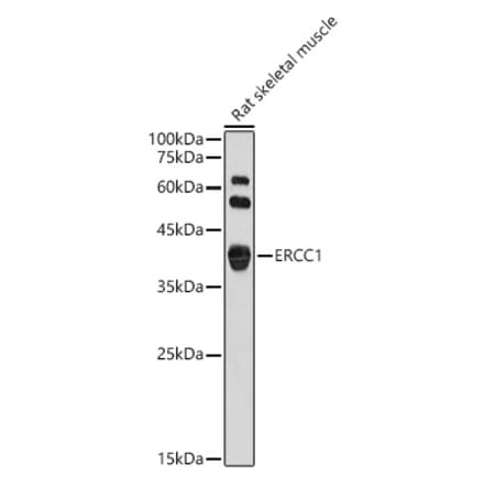 Western Blot - Anti-ERCC1 Antibody (A14641) - Antibodies.com