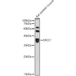 Western Blot - Anti-ERCC1 Antibody (A14641) - Antibodies.com