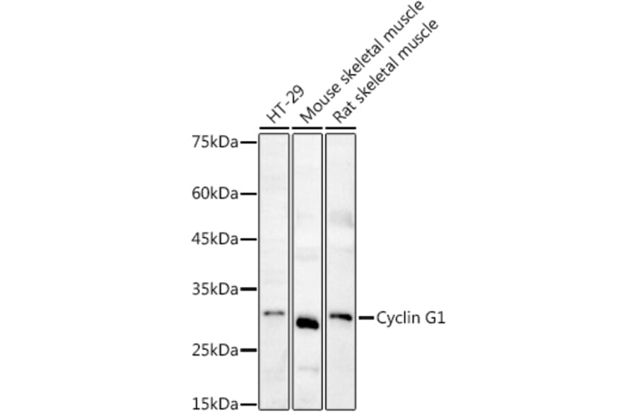 Western Blot - Anti-CyclinG Antibody (A14642) - Antibodies.com