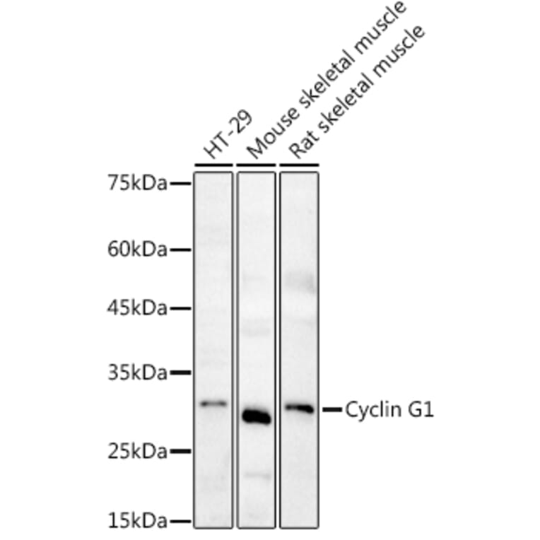 Western Blot - Anti-CyclinG Antibody (A14642) - Antibodies.com