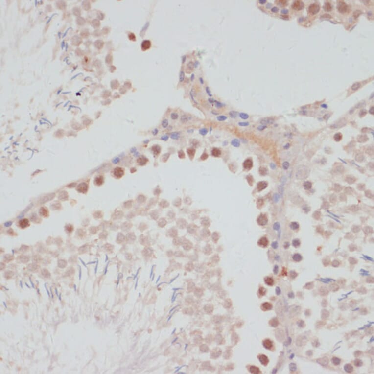 Immunohistochemistry - Anti-CyclinG Antibody (A14642) - Antibodies.com