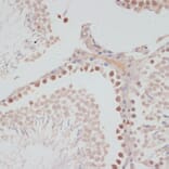 Immunohistochemistry - Anti-CyclinG Antibody (A14642) - Antibodies.com