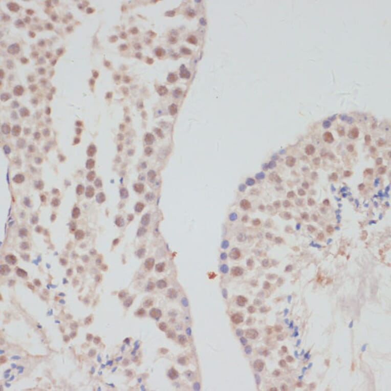 Immunohistochemistry - Anti-CyclinG Antibody (A14642) - Antibodies.com