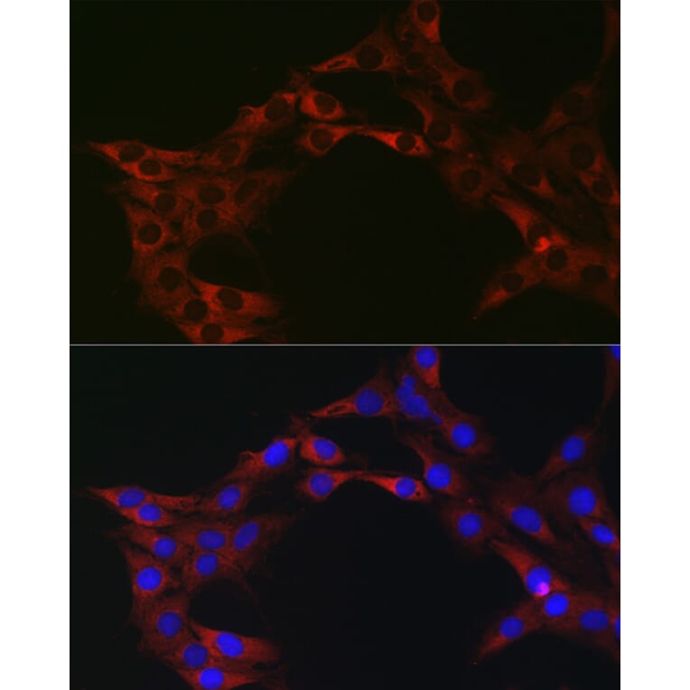 Immunofluorescence - Anti-eIF4A1 Antibody (A14643) - Antibodies.com