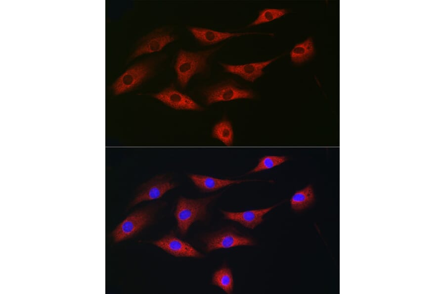 Immunofluorescence - Anti-eIF4A1 Antibody (A14643) - Antibodies.com