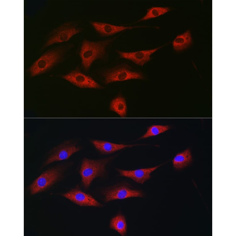 Immunofluorescence - Anti-eIF4A1 Antibody (A14643) - Antibodies.com