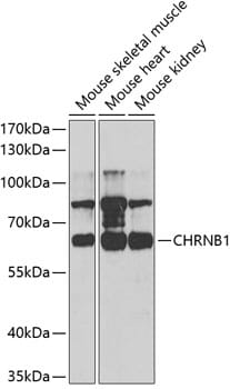 Western blot analysis of extracts of various cell lines, using Anti-CHRNB1 Antibody (A5295) at 1:1,000 dilution.
Secondary antibody: Goat Anti-Rabbit IgG (H+L) (HRP) (AS014) at 1:10,000 dilution.
Lysates / proteins: 25µg per lane.
Blocking buffer: 3% non-fat dry milk in TBST.
Detection: ECL Basic Kit (RM00020).
Exposure time: 90s.