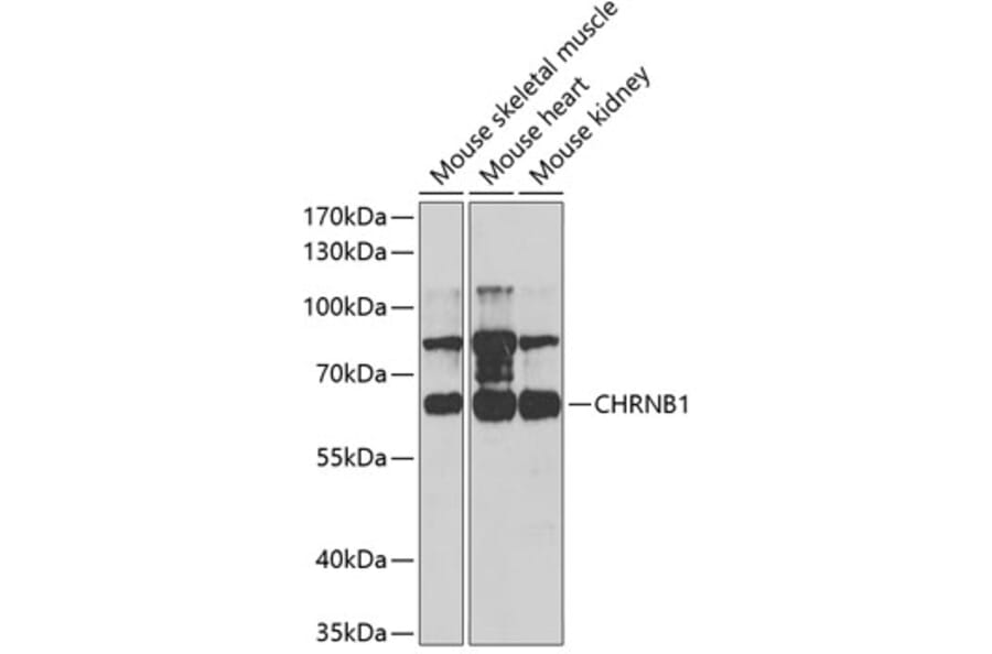 Western Blot - Anti-Nicotinic Acetylcholine Receptor beta/CHRNB1 Antibody (A14644) - Antibodies.com