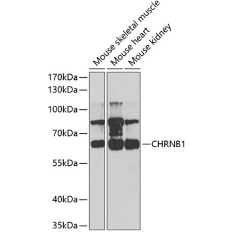Western Blot - Anti-Nicotinic Acetylcholine Receptor beta/CHRNB1 Antibody (A14644) - Antibodies.com
