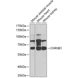 Western Blot - Anti-Nicotinic Acetylcholine Receptor beta/CHRNB1 Antibody (A14644) - Antibodies.com