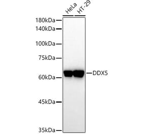 Western Blot - Anti-DDX5 Antibody (A14645) - Antibodies.com