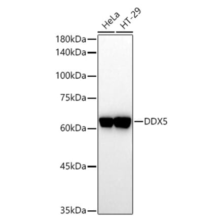 Western Blot - Anti-DDX5 Antibody (A14645) - Antibodies.com