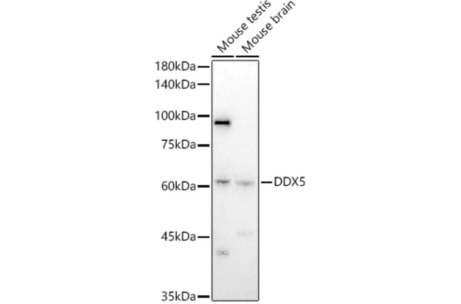 Western Blot - Anti-DDX5 Antibody (A14645) - Antibodies.com