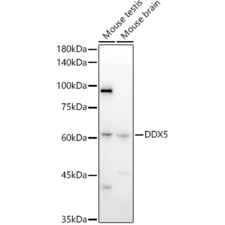 Western Blot - Anti-DDX5 Antibody (A14645) - Antibodies.com