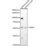 Western Blot - Anti-DDX5 Antibody (A14645) - Antibodies.com