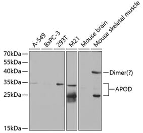Western Blot - Anti-Apo-D Antibody (A14646) - Antibodies.com