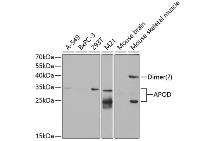 Western Blot - Anti-Apo-D Antibody (A14646) - Antibodies.com