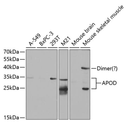 Western Blot - Anti-Apo-D Antibody (A14646) - Antibodies.com