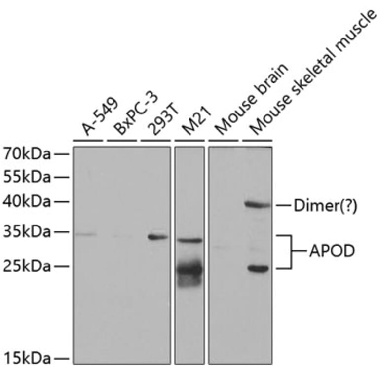 Western Blot - Anti-Apo-D Antibody (A14646) - Antibodies.com