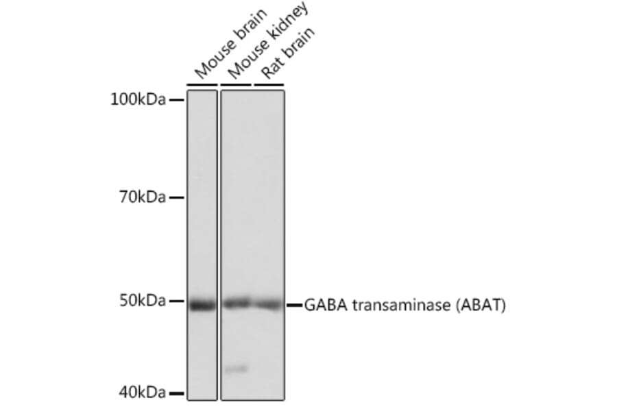 Western Blot - Anti-ABAT/GABA-T Antibody (A14647) - Antibodies.com
