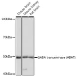 Western Blot - Anti-ABAT/GABA-T Antibody (A14647) - Antibodies.com