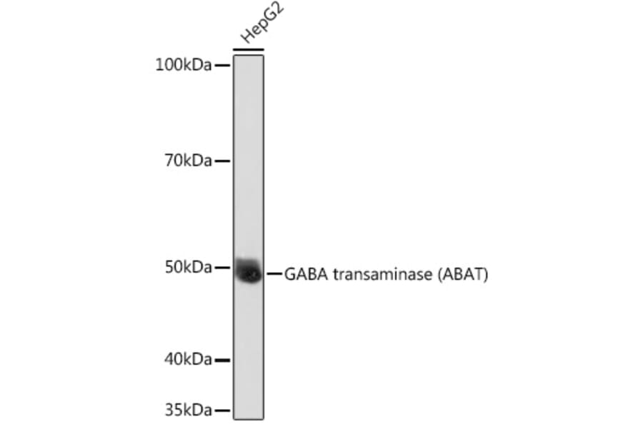 Western Blot - Anti-ABAT/GABA-T Antibody (A14647) - Antibodies.com