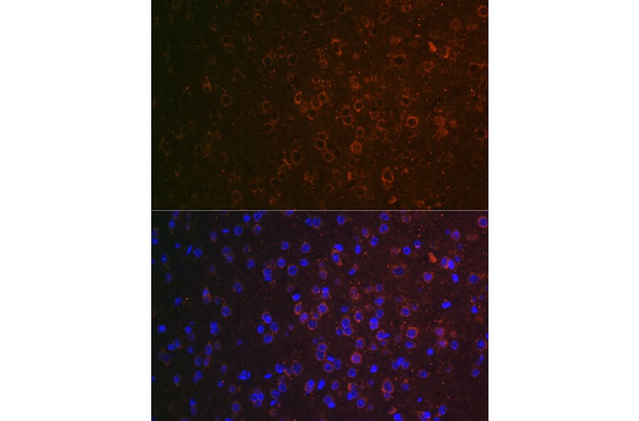 Immunofluorescence - Anti-ABAT/GABA-T Antibody (A14647) - Antibodies.com