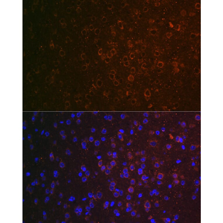 Immunofluorescence - Anti-ABAT/GABA-T Antibody (A14647) - Antibodies.com
