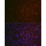 Immunofluorescence - Anti-ABAT/GABA-T Antibody (A14647) - Antibodies.com