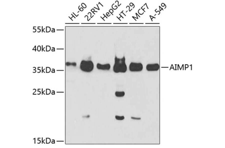Western Blot - Anti-EMAP II/AIMP1 Antibody (A14649) - Antibodies.com