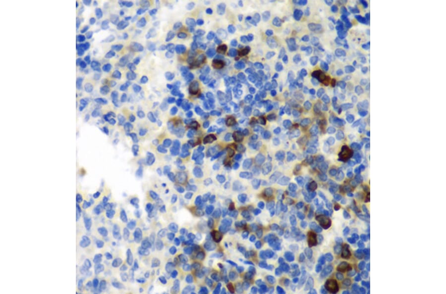 Immunohistochemistry - Anti-EMAP II/AIMP1 Antibody (A14649) - Antibodies.com