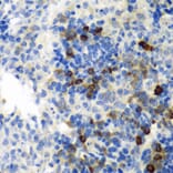 Immunohistochemistry - Anti-EMAP II/AIMP1 Antibody (A14649) - Antibodies.com